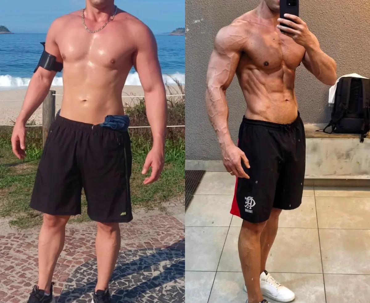 Resultado de paciente acompanhado por Matheus Ferreira