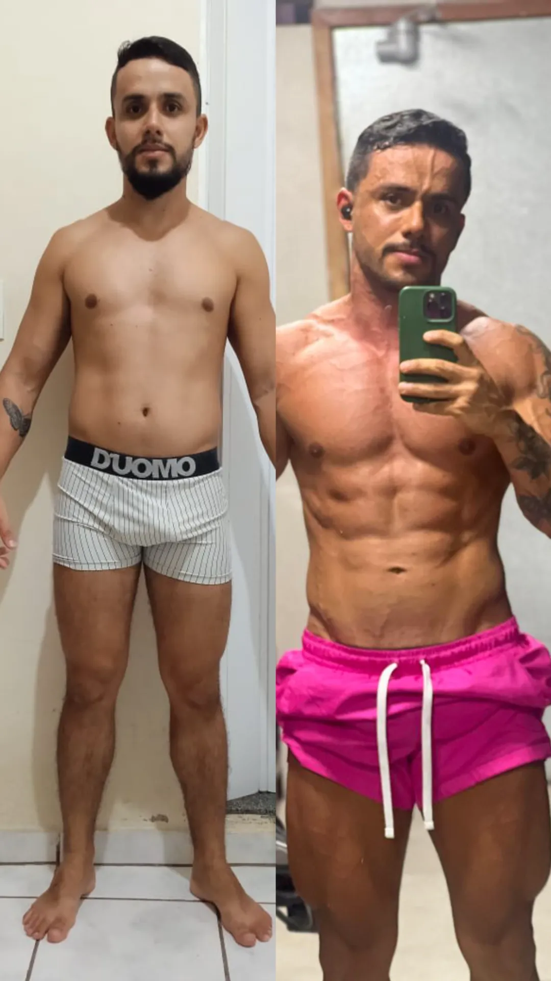 Resultado de paciente acompanhado por Matheus Ferreira