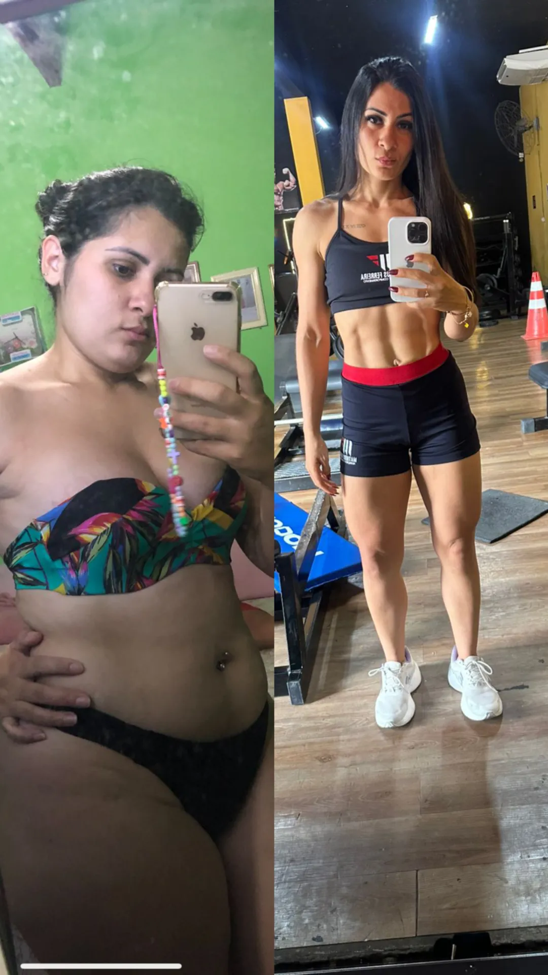 Resultado de paciente acompanhado por Matheus Ferreira